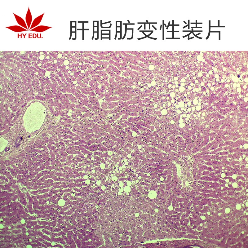 肝脂肪变性装片  高教标准  显微镜玻片 病理组织细胞 生物切片 成像清晰