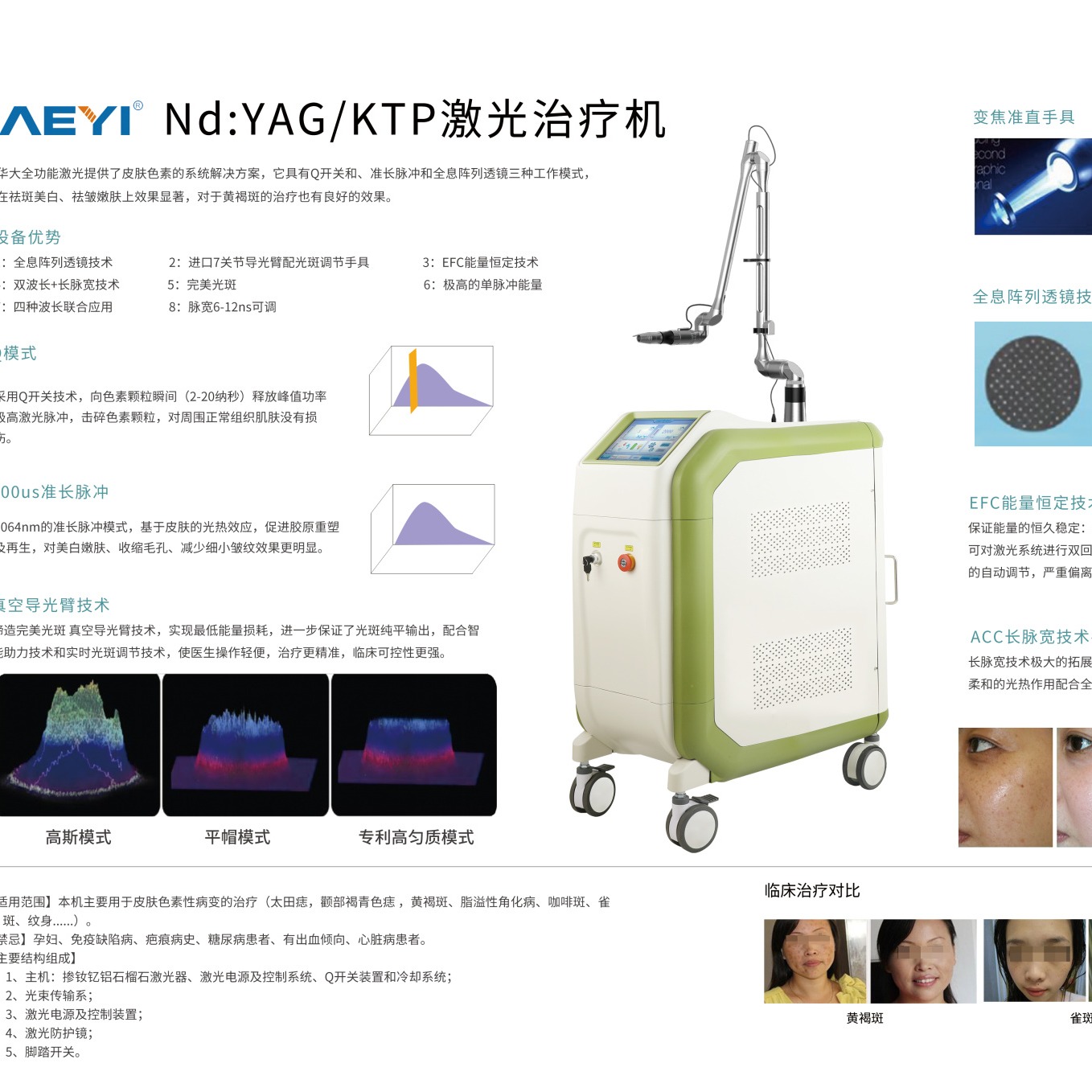 YAG激光治疗机皮肤色素激光治疗仪 YAG/KTP激光治疗机